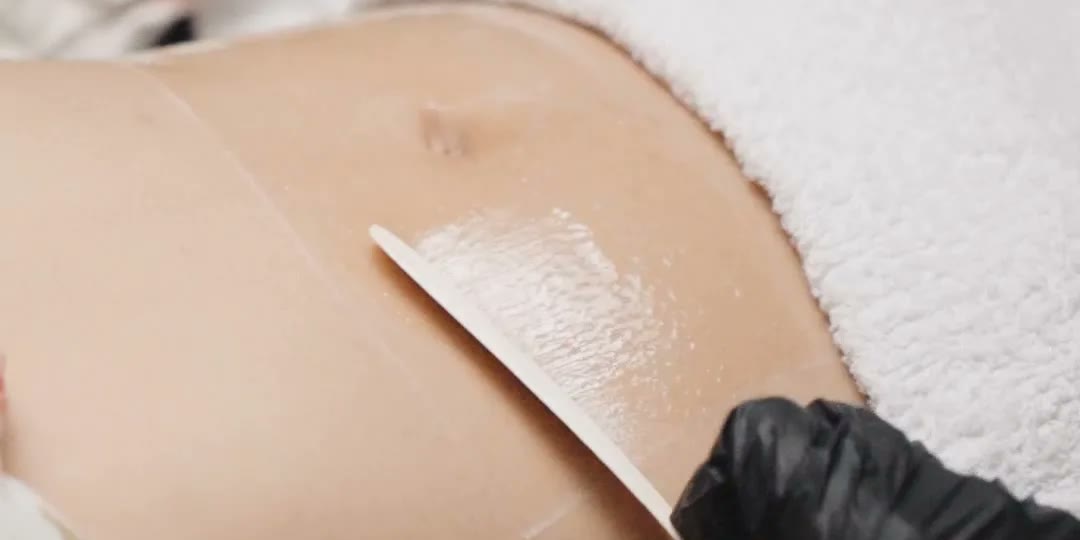 Venus Aesthetics clinical treatment