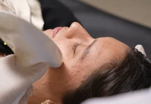 Venus Scar Free for Acne Scars at Venus Aesthetics