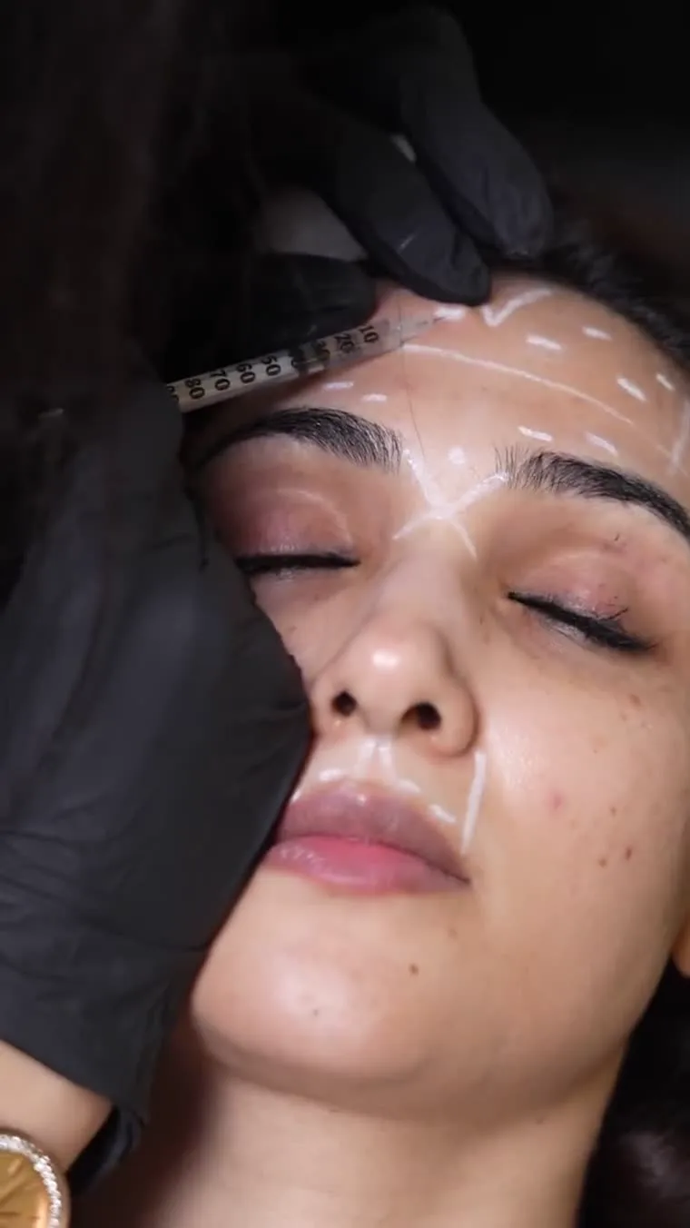 Doctor consultation before Botox treatment at Venus Aesthetics