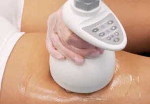 Venus Legacy body contouring session at Venus Aesthetics