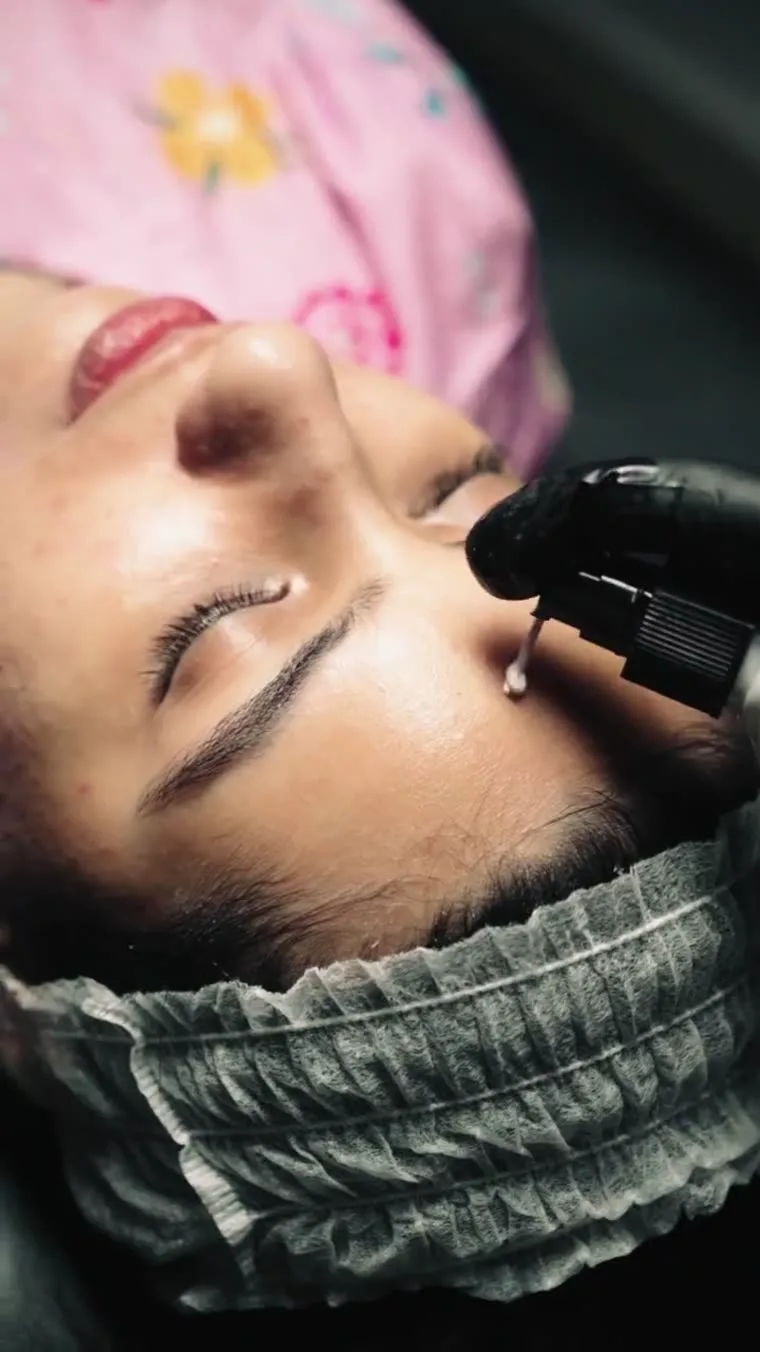 Medical-grade peel application at Venus Aesthetics
