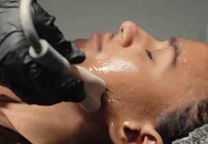 Venus Face Lift at Venus Aesthetics