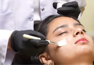 Party Peel at Venus Aesthetics