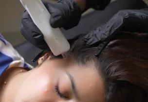 Venus Scalp Detox at Venus Aesthetics