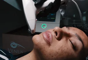 Venus Clear at Venus Aesthetics