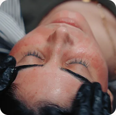 Scalp detox deep-cleansing treatment at Venus Aesthetics