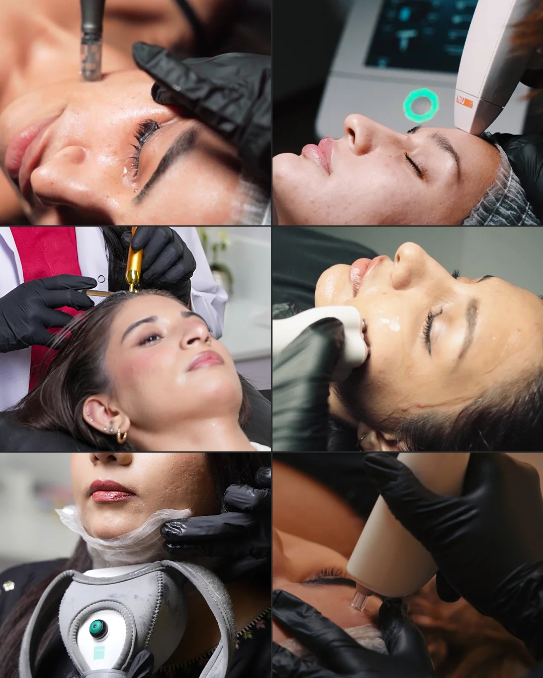 Measured results reviewed at a Venus Aesthetics follow-up
