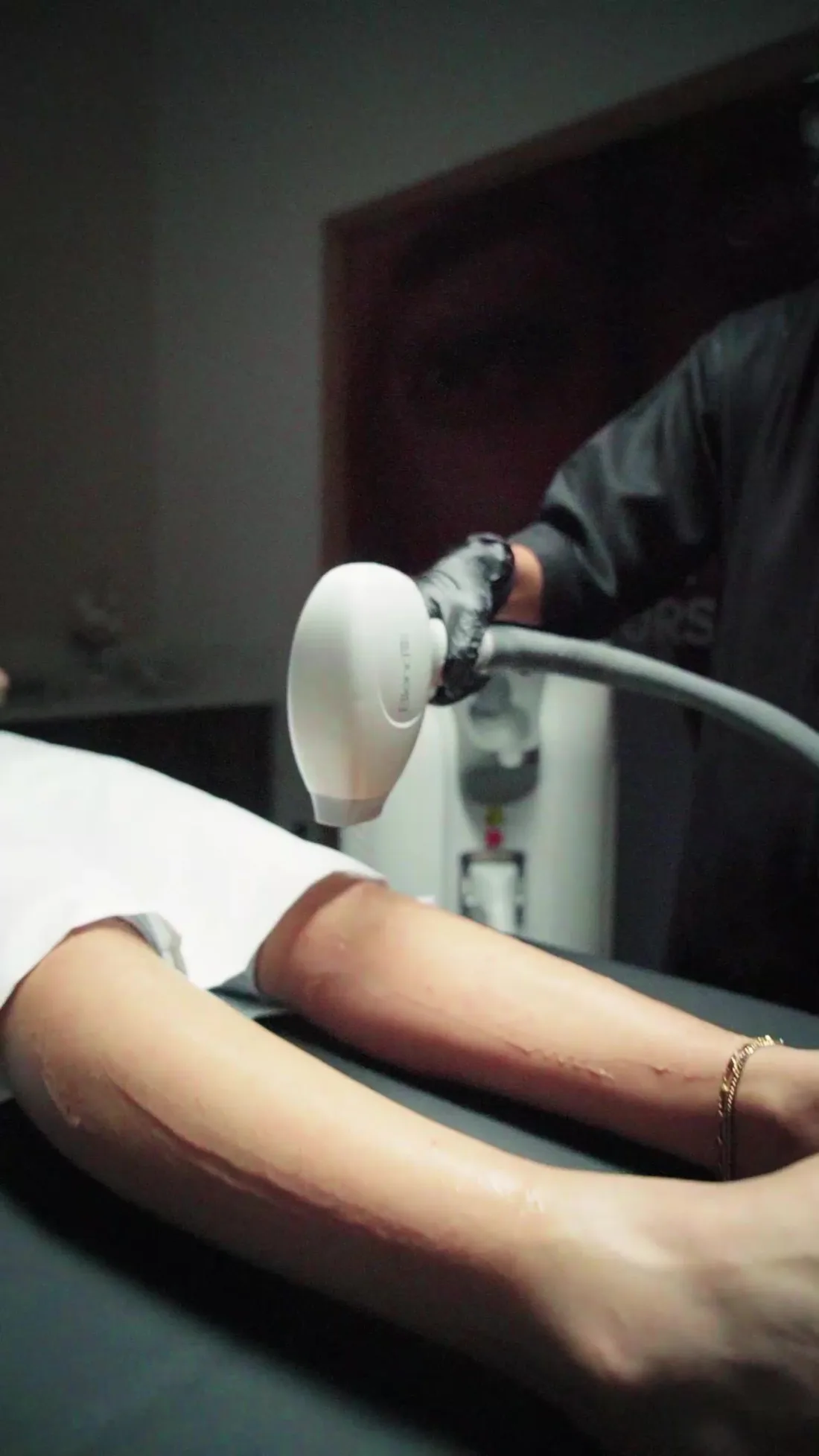 Laser hair removal session at Venus Aesthetics Pakistan