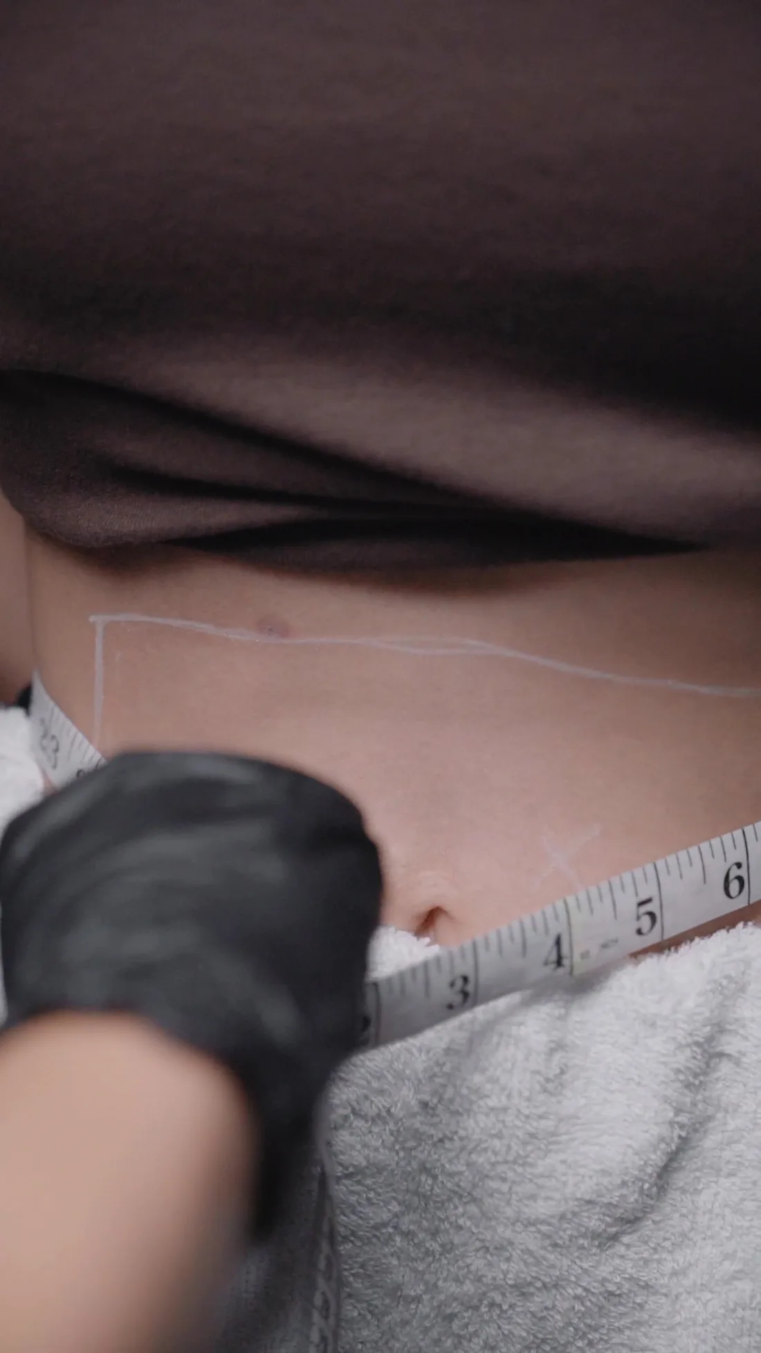 Waist measurement during a Venus SlimFit medical weight loss review